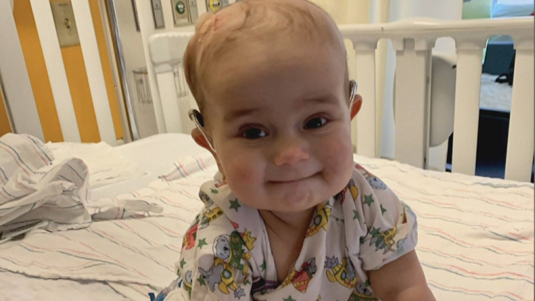 WBZ Story: Baby’s Cancer Battle Inspires PMC Community